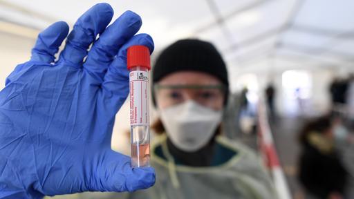 Koronapandemie: 11.409 Neuinfektionen in Deutschland |  tagesschau.de