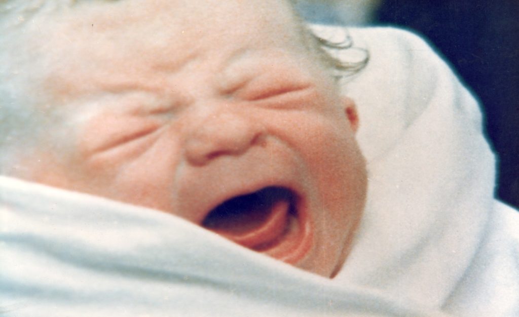 Baby mit Zwilling im Mutterleib in extrem seltener Schwangerschaft geboren