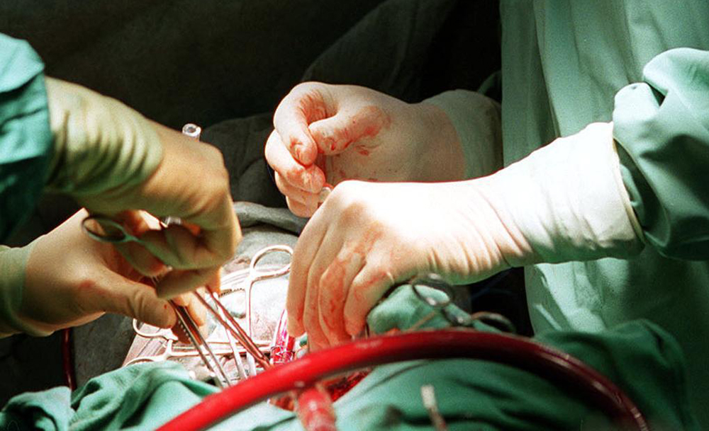 Chirurg mit Geldstrafe in Höhe von 3.000 US-Dollar belegt, weil er ein Bein amputiert hat